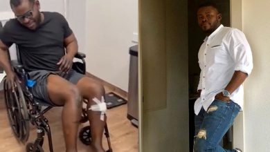 The American spent over 1.4 crore on surgeries to get taller |  World news