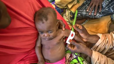 80, 000 Malnourished Children In Nigeria Risk Losing Aid — UNICEF