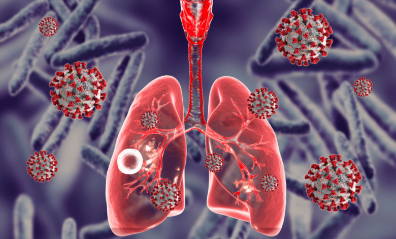 Funding gaps, limited facilities threaten Nigeria’s TB progress – Health Minister Funding gaps, limited facilities threaten Nigeria’s TB progress – Health Minister