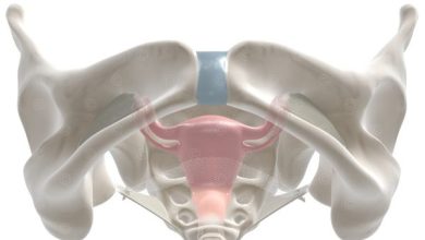 PT Health Watch: What you should know about pelvic inflammatory disease and how to prevent it