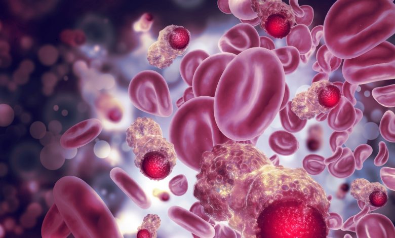 PT Health Watch: Poor awareness still driving new sickle cell cases in Nigeria – Advocate PT Health Watch: Poor awareness still driving new sickle cell cases in Nigeria – Advocate