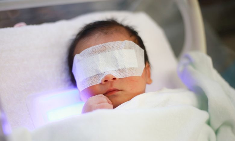 PT Health Watch: What you should know about jaundice in children and adults PT Health Watch: What you should know about jaundice in children and adults