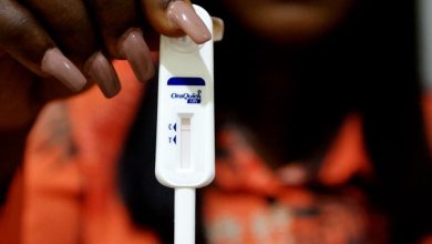 NIMR working on HIV gel to prevent infection among women