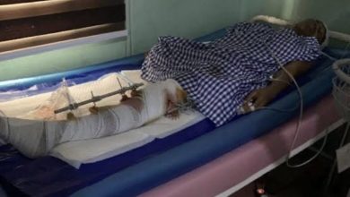 Dangote Cement moves to support Phyna’s sister following Auchi crash, leg amputation