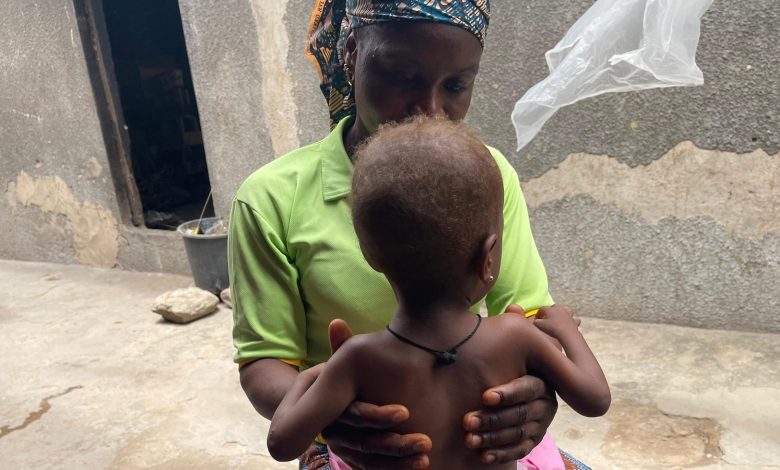 SPECIAL REPORT: Food Inflation worsens child malnutrition crisis in northern Nigeria SPECIAL REPORT: Food Inflation worsens child malnutrition crisis in northern Nigeria