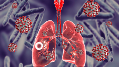 PT Health Watch: What you should know about Tuberculosis, why it persists