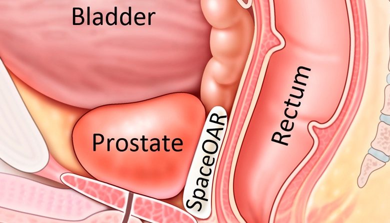 Frequent ejaculation may lower prostate cancer risk- Expert Frequent ejaculation may lower prostate cancer risk- Expert
