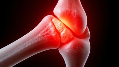 Chinese firm unveils bone adhesive that repairs fractures within minutes